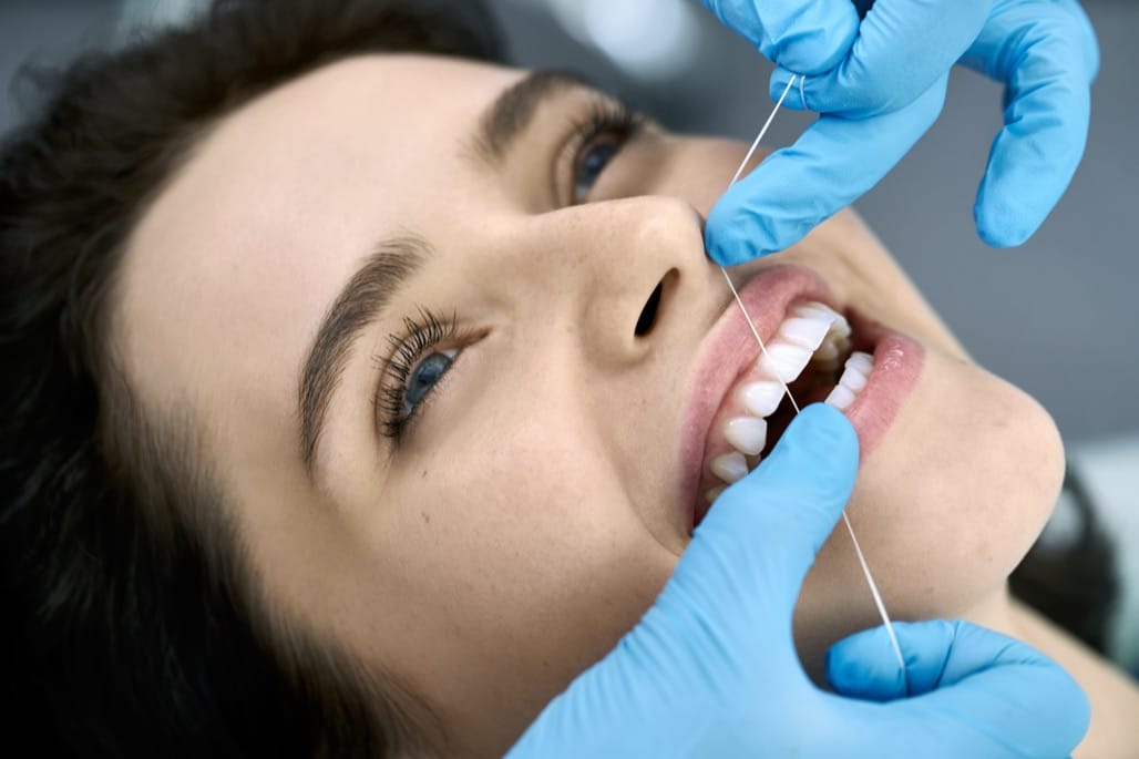 Teeth Cleaning Near Me in Hoffman Estates