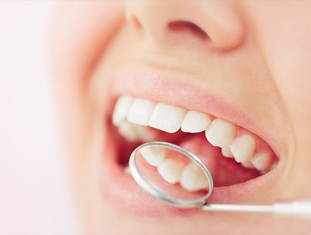Dental Crowns or Cavity Fillings Treatment Near Me in Hoffman Estates