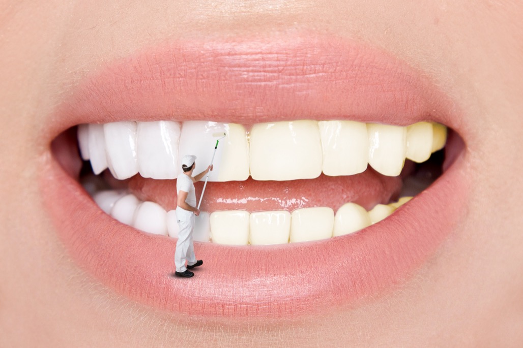 Teeth Whitening Treatment Near Me in Hoffman Estates