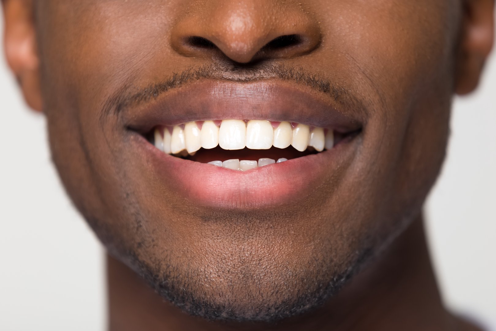 Best Dentist Near Me in Hoffman Estates, IL