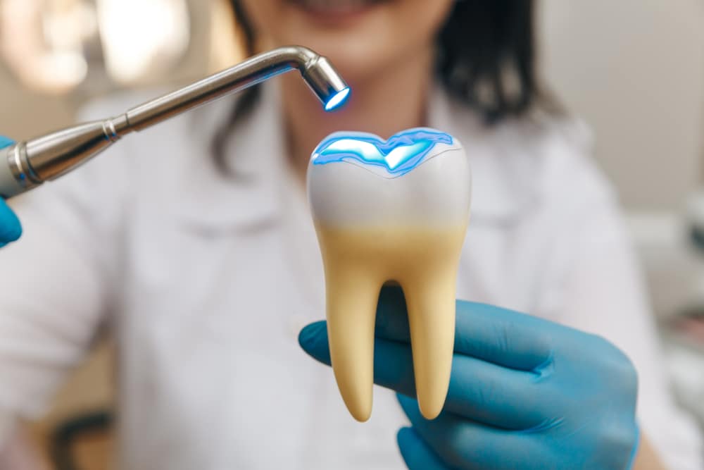 When Do I Need White, Tooth-Colored Fillings? Hoffman Estates IL